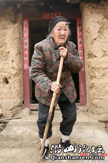 河南鲁山百岁老人头上长犄角 不疼也不痒(组图