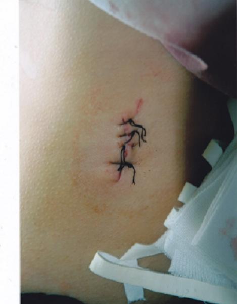 令人震惊的济宁群体流血事件 - 天柱茶馆 - 潜山